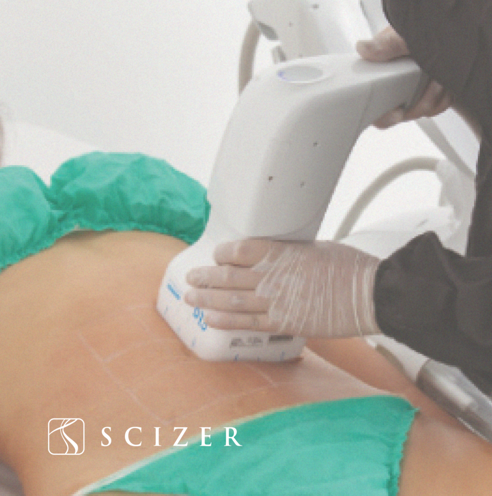 scizer tratamiento sin cirugia